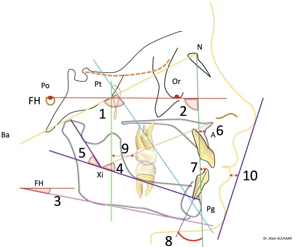 Méthode analyse de Ricketts